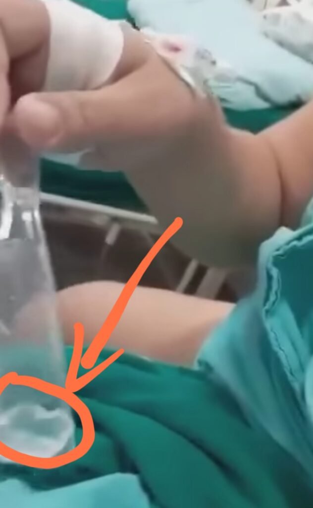 VÍDEO: Grávidas denunciam comida estragada e com plástico esta sendo disponibilizado no Hospital de Base VÍDEO: Grávidas denunciam comida estragada e com plástico esta sendo disponibilizado no Hospital de Base